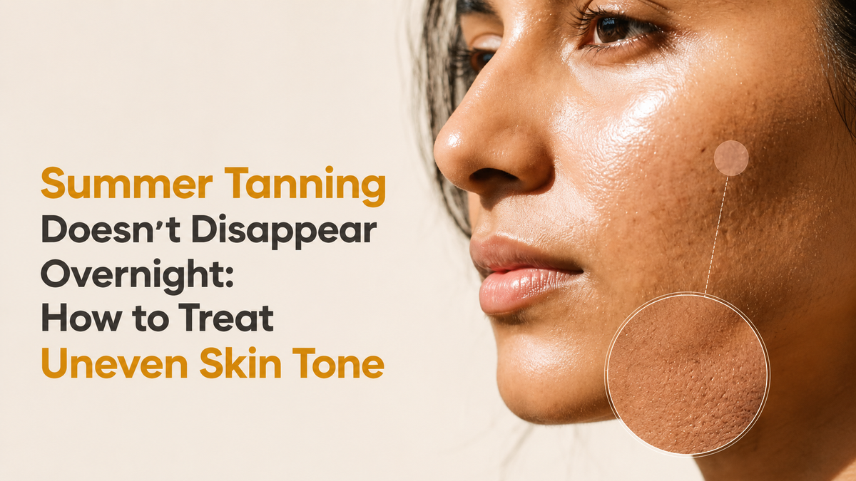 Summer Tan Doesn’t Disappear Overnight: How to Treat Uneven Skin Tone